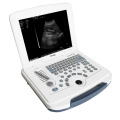 2017 hot sale ultrasound machine portátil e ultrasonidos